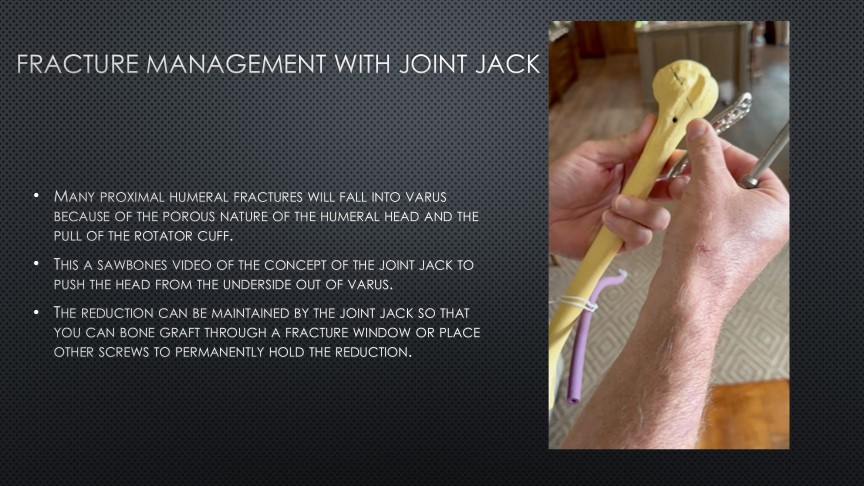 Joint Jack.svg